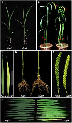 SiYGL2 Is Involved in the Regulation of Leaf Senescence and Photosystem II Efficiency in Setaria italica (L.) P. Beauv.